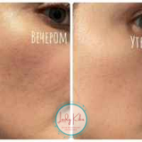 Нічна вітамінна маска на основі прополіса і обліпихи iUNIK Propolis Vitamin Sleeping Mask, 60ml, фото 7