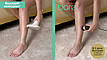 Фотоепілятор SmoothSkin Bare + IPL Hair Removal (C БЕЗЛІМІТНИМ РЕСУРСОМ), фото 8