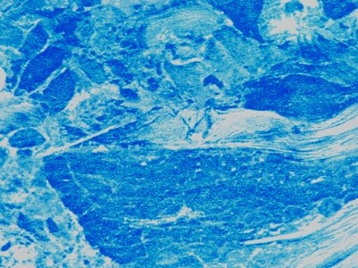 Плівка ПВХ ALKORPLAN 3000 MARBLE CLASSIC