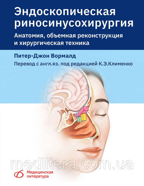 Волмард Ендоскопічна риносинусохирургия. Анатомія, об'ємна реконструкція та хірургічна техніка 2021 р