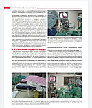 Волмард Ендоскопічна риносинусохірургія. Анатомія, об'ємна реконструкція та хірургічна техніка 2021 р, фото 6