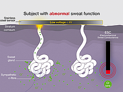 Комплект електродів для рук та для ніг на 100 аналізів
