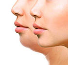 Маска бандаж Maskini для корекції овалу обличчя й другого підборіддя, фото 7