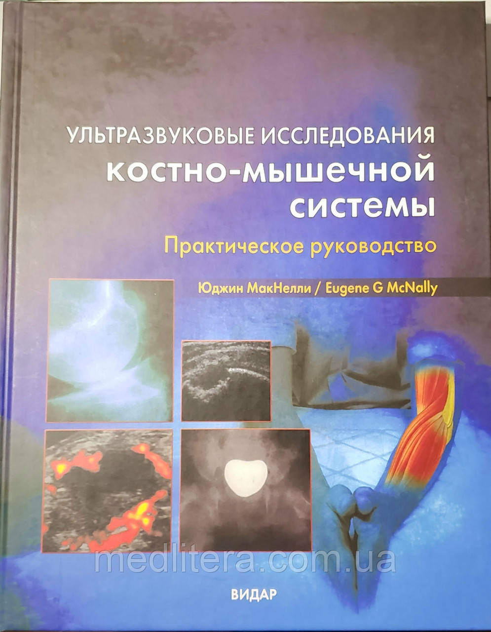 Юджин Мак Нелли / Макнелли Ультразвуковая диагностика костно-мышечной системы / УЗИ костно-мышечной системы - фото 1 - id-p41780572