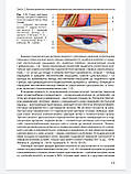 Носенко, Дадова Ультразвукове дослідження артерій і вен верхніх кінцівок, фото 6