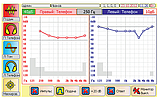 Аудіометр Auditus-A1, фото 6