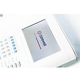 1112M електрокардіограф 12 — канальний, фото 5