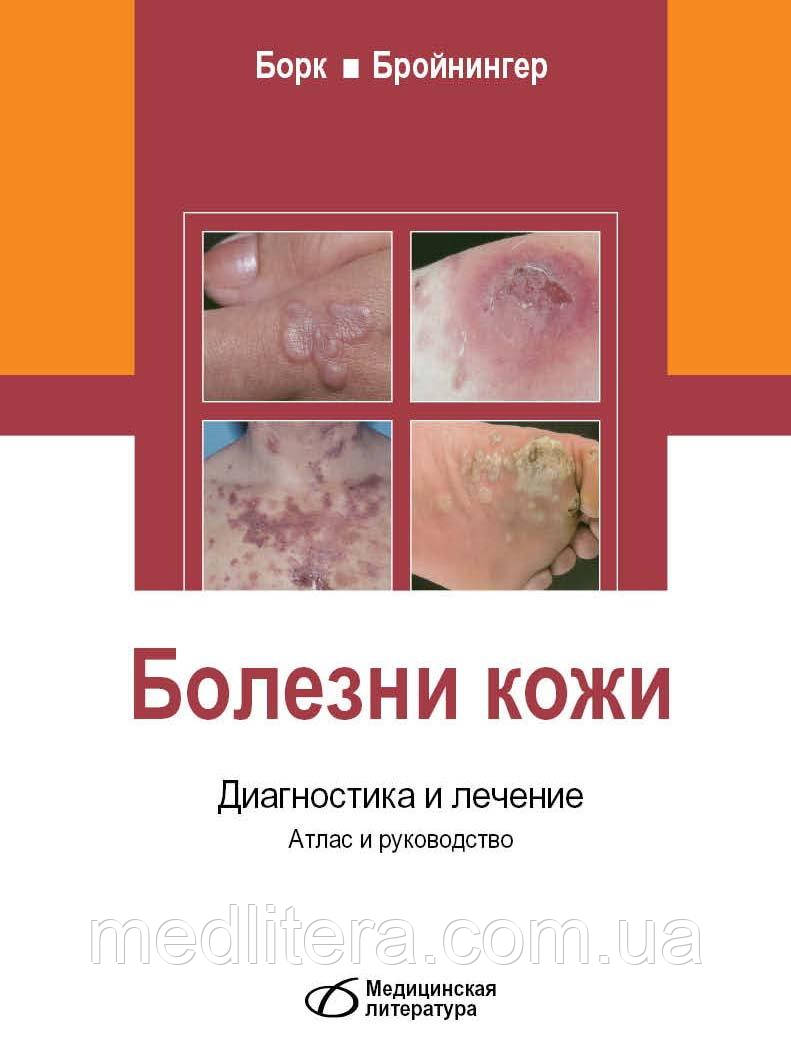 Хвороби шкіри. Діагностика і лікування. Атлас і керівництво - Борк К.