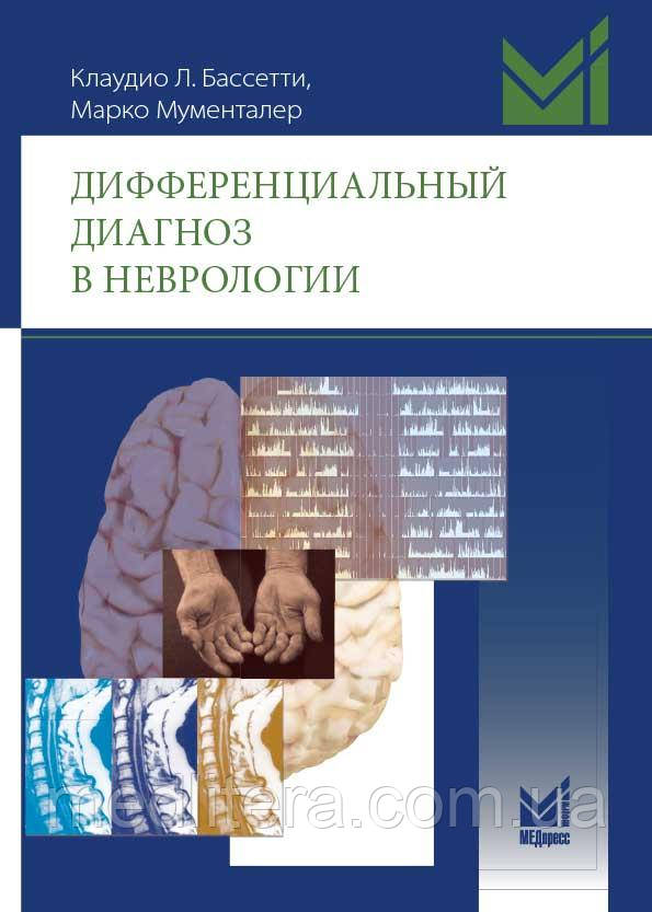 Диференціальний діагноз у неврології - Мументалер М.