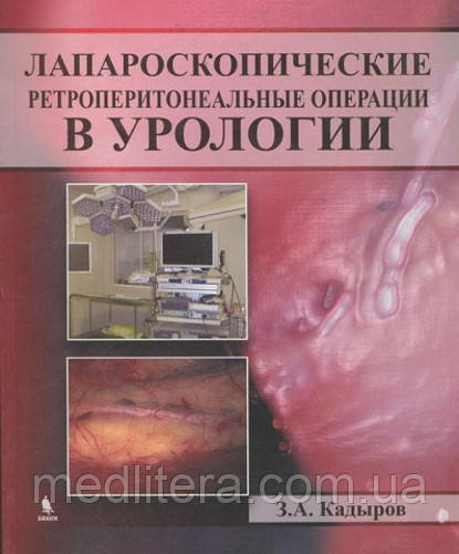 Лапароскопічні ретроперитонеальні операції в урології - Кадиров З. А.