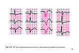Електрокардіограма: аналіз і інтерпретація - Струтынский А. В., фото 7