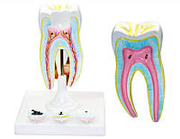 Будова корінного зуба людини модель разбірна масштаб 1:5 19 см