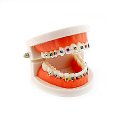 Демонстраційна модель в стоматології