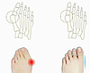 Коректор роздільник для пальців ніг 9х2.5х1.6, фото 6