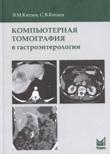 

Китаев В.М., Китаев С.В. Компьютерная томография в гастроэнтерологии 2019 год
