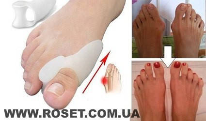 

Фиксатор для коррекции косточки на ноге Valgus Pro