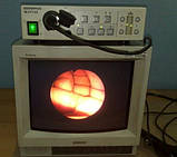 Оптичний Ендоскоп Olympus JF-1T10 Duodenoscope, фото 5