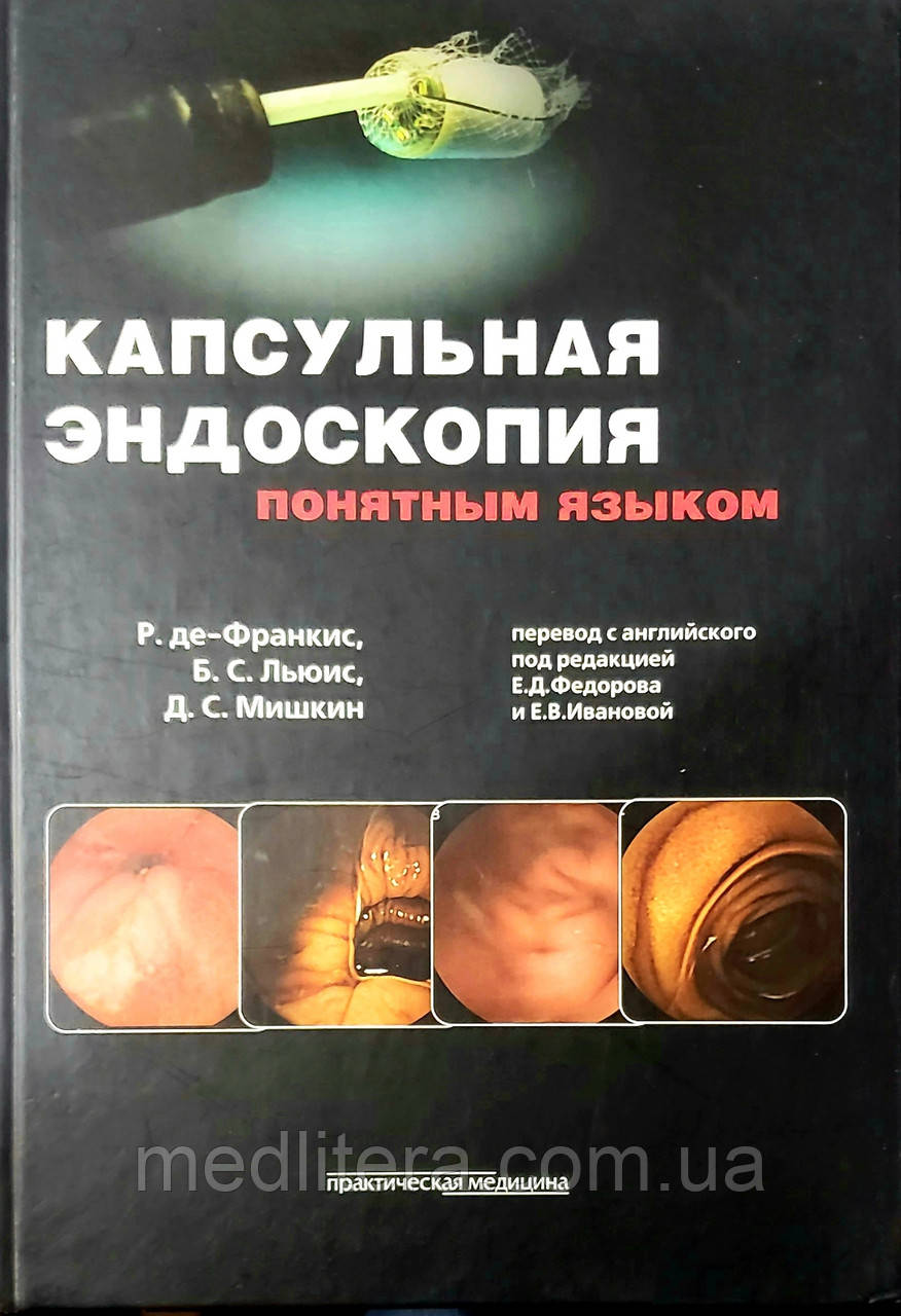 Франкис Р. Капсульна ендоскопія зрозумілою мовою