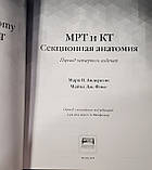 Марк Андерсон Ст., Фокс Майкл Дж. МРТ і КТ. Секційна анатомія, фото 3