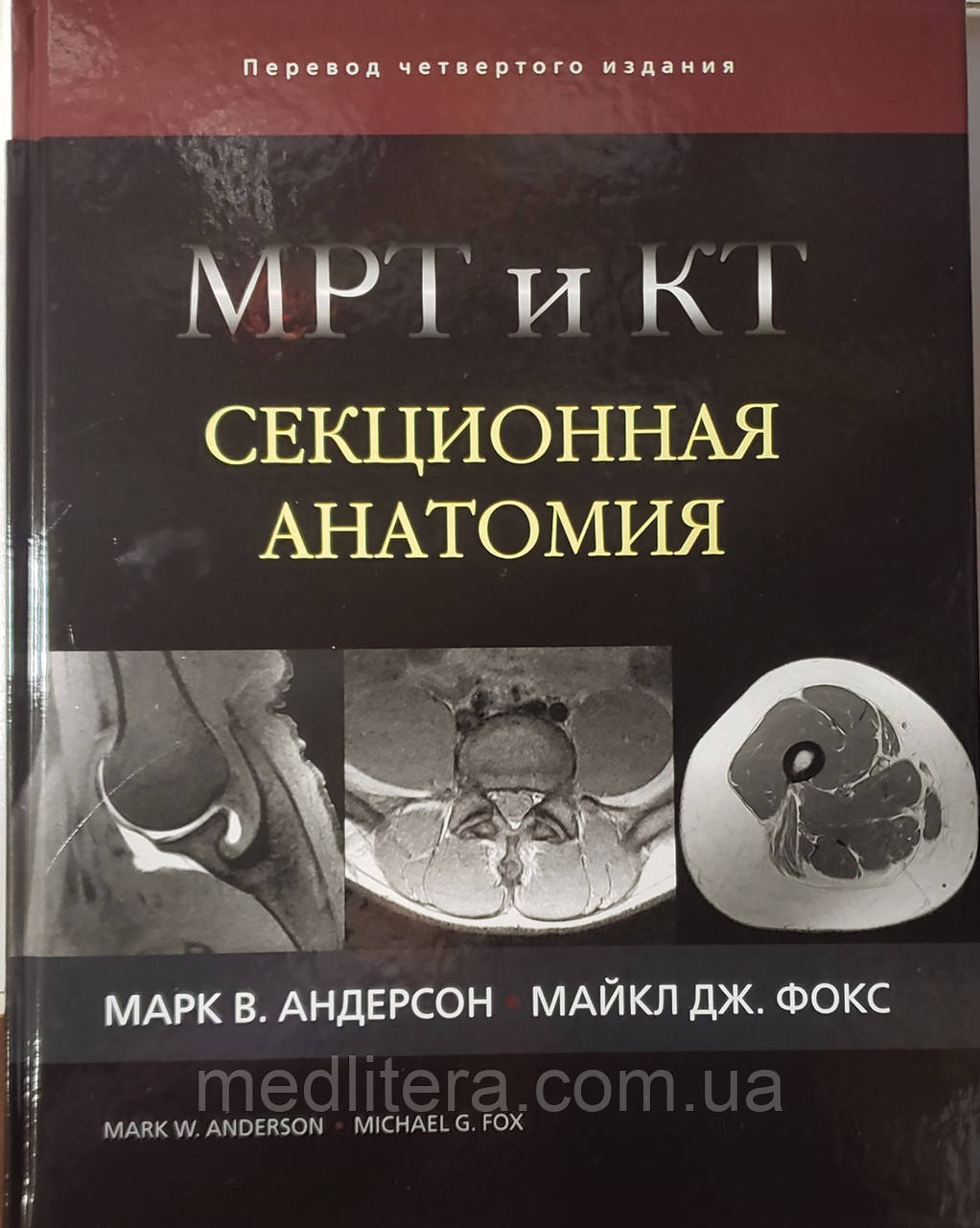 Марк Андерсон Ст., Фокс Майкл Дж. МРТ і КТ. Секційна анатомія