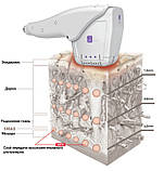 Апарат для SMAS ліфтингу UCOS-HIFU 2020 р. в., фото 7