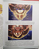 Воробйов А. А. Естетична анатомія шиї 2019 рік керівництво для лікарів, фото 6