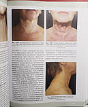 Воробйов А. А. Естетична анатомія шиї 2019 рік керівництво для лікарів, фото 4