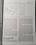 Філліпс Р. К. С. Колоректальна хірургія, Керівництво для проктолога, хірурга пер з англ під ред Воробйова, фото 5