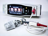 Переносний або Приліжковий Пульсоксиметр MASIMO RADICAL-7 Pulse CO-Oximeter (Used), фото 4