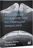 Адгезивные керамические реставрации передних зубов - Манье П., Бельсер Ю.