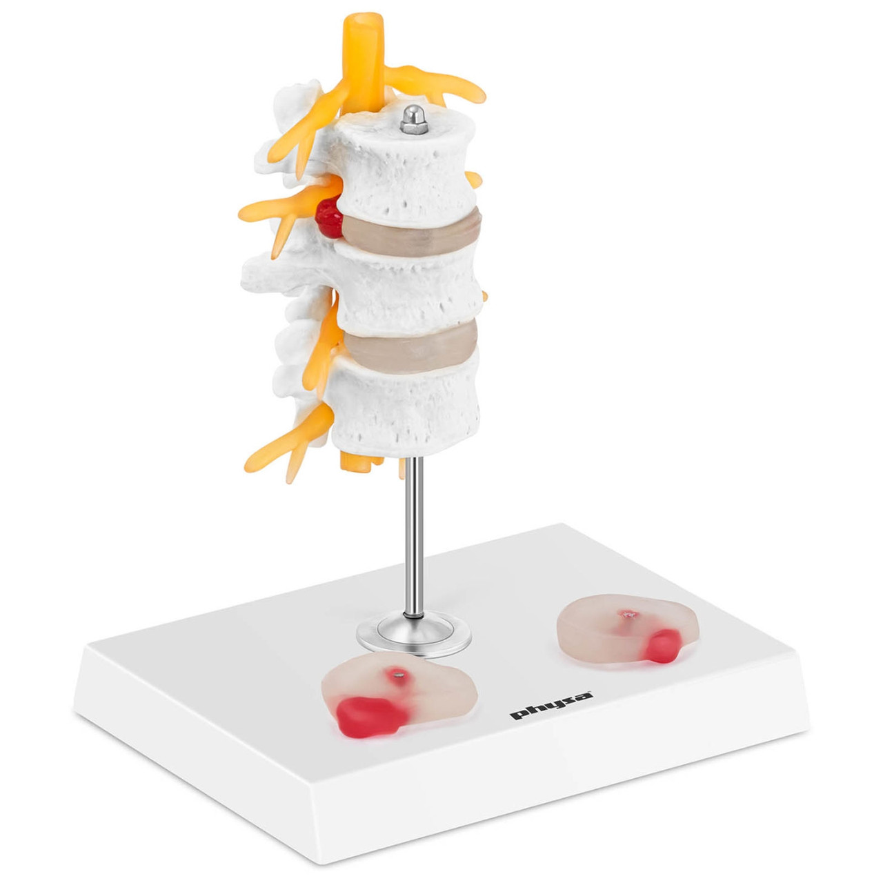 3D анатомическая модель поясничного отдела позвоночника с грыжей 3-5 позвонков - фото 2 - id-p1390493078