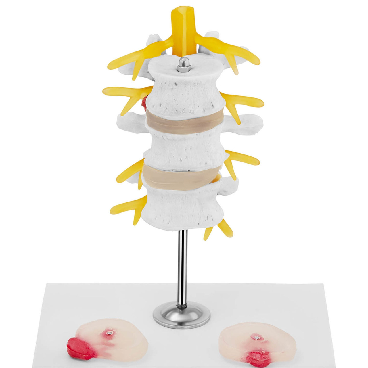 3D анатомическая модель поясничного отдела позвоночника с грыжей 3-5 позвонков - фото 4 - id-p1390493078