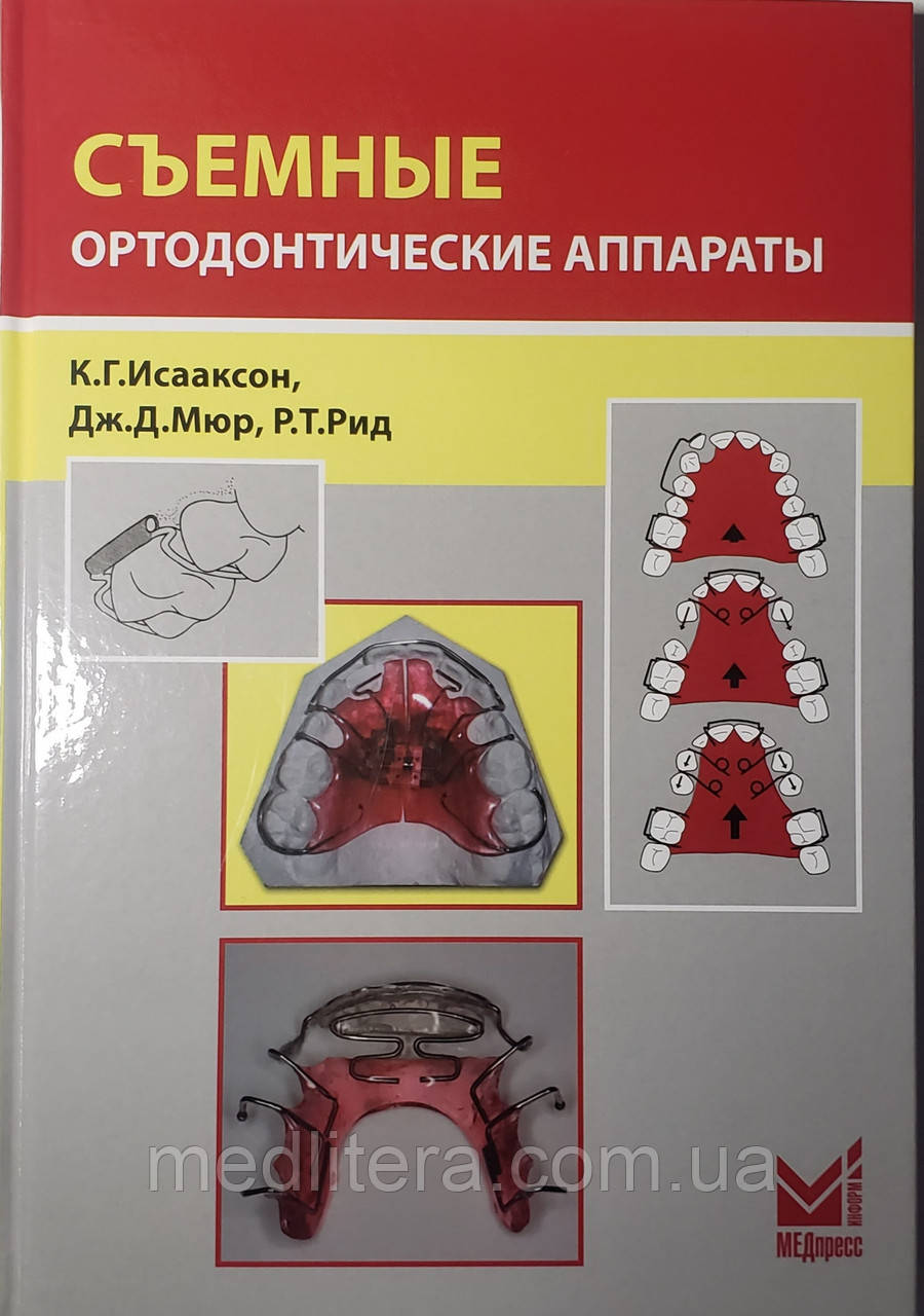 Ісааксон К. Р., Мюр Дж.Д. Знімні ортодонтичні апарати 3-е видання 2018 рік