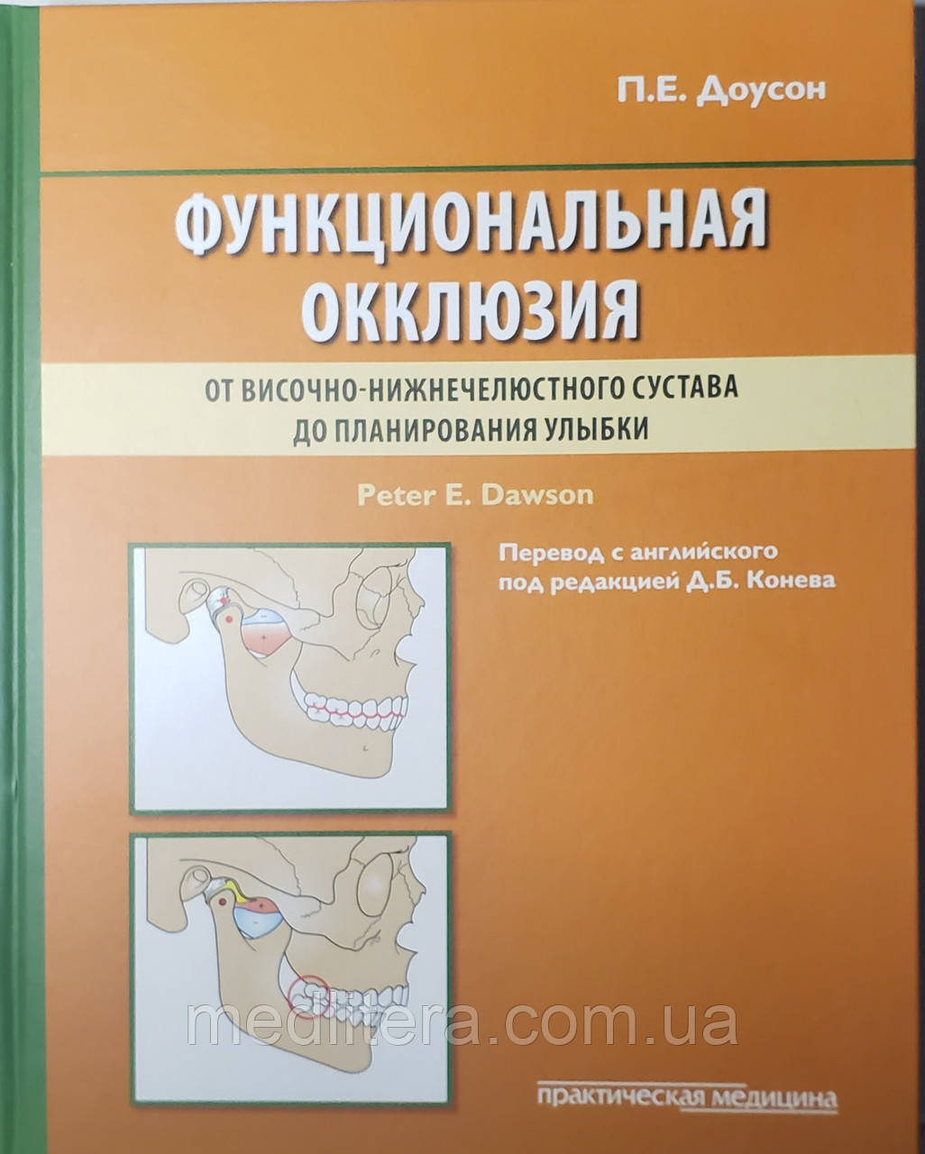 Доусон Пітер Е. Функціональна оклюзія. Від скронево-нижньощелепного суглоба до планування усмішки