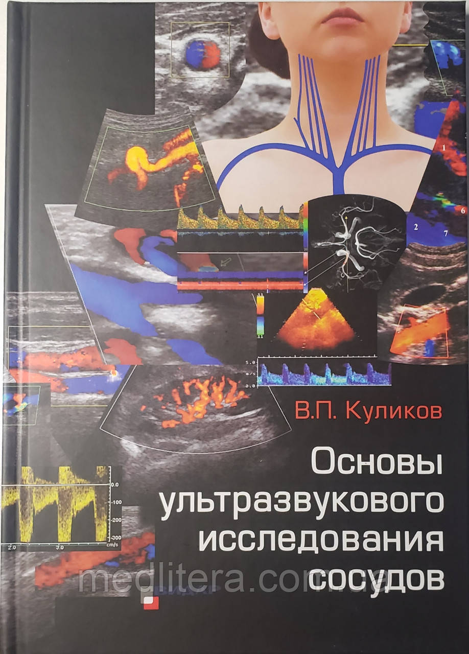 Куликов В. П. Основи ультразвукового дослідження судин / УЗІ судин