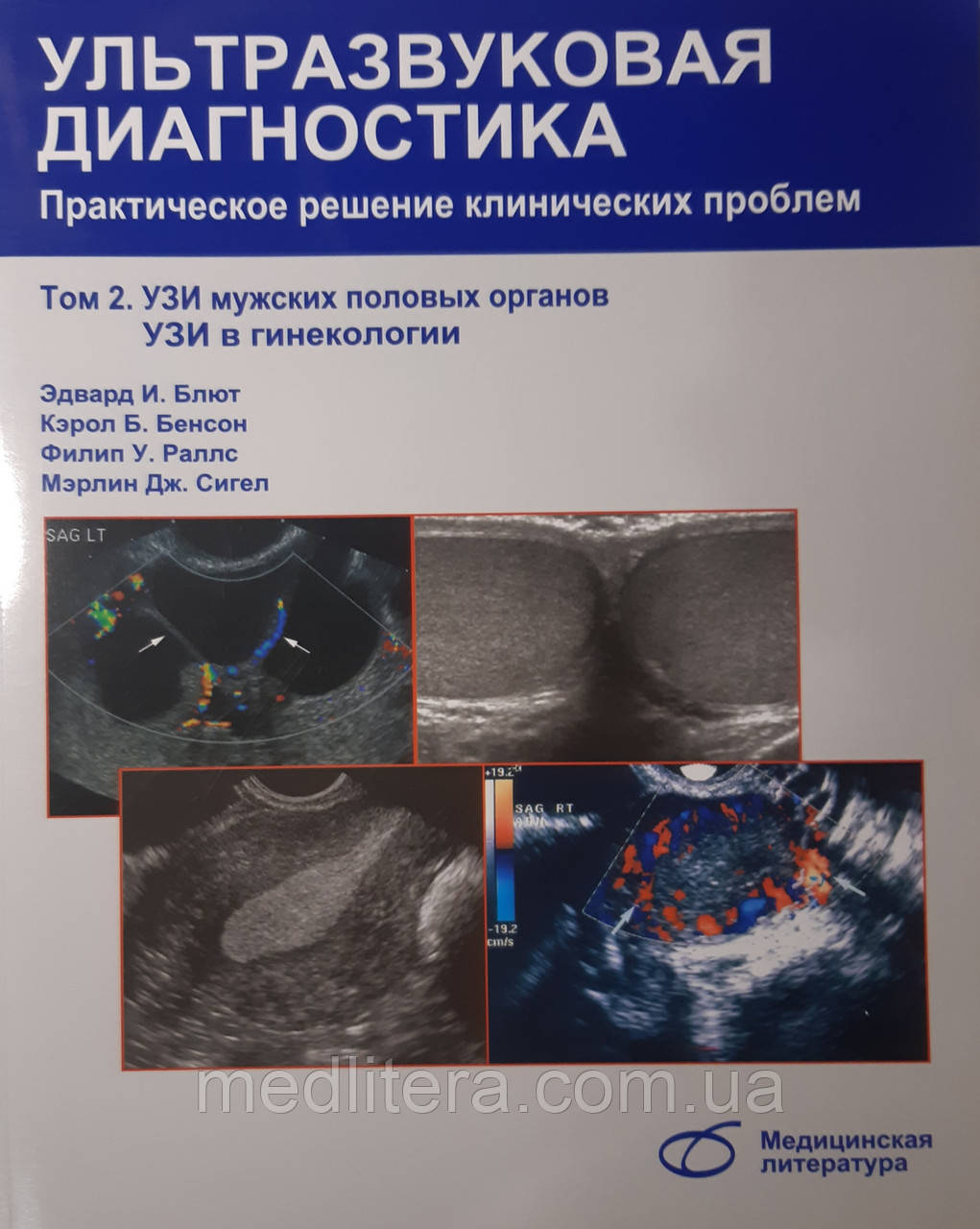 Блют Е Ультразвукова діагностика том 2 Практичне розв'язання клінічних проблем. ЗІТІ чоловічих статевих органів