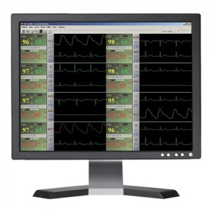 Встроенный монитор пациента UTAS - фото 1 - id-p1392541220