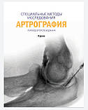 Крим Р. Дж. Артрографія узд, фото 3