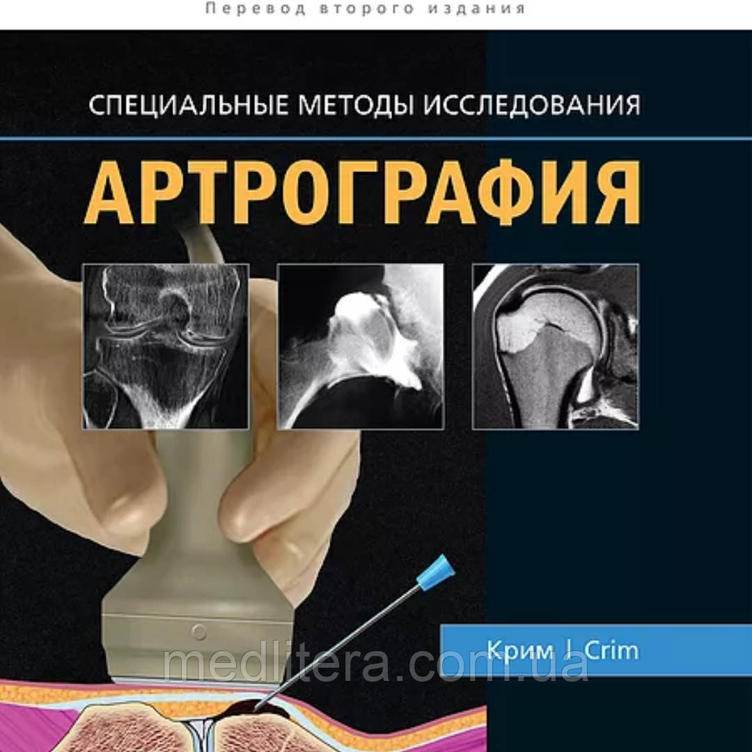 Крим Р. Дж. Артрографія узд
