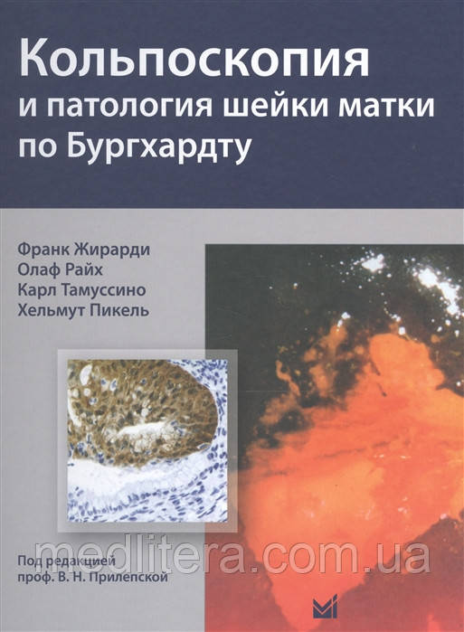 Жирарди Ф. Кольпоскопія і патологія шийки матки за Бургхардту посібник-атлас по кольпоскопії