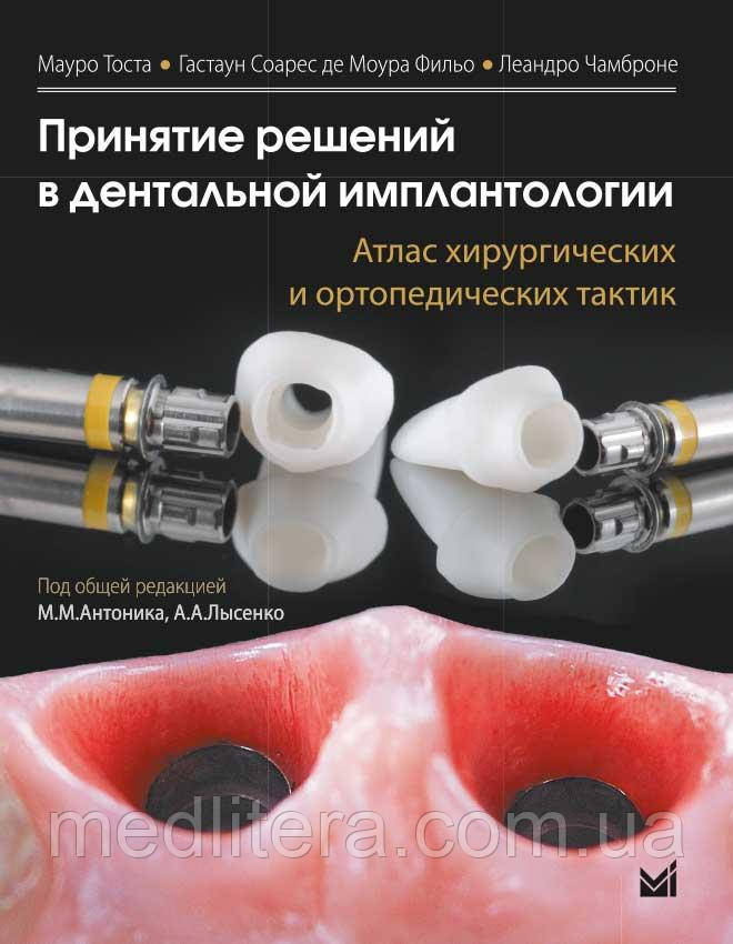 Тосту Мауро Прийняття Рішень в дентальної імплантології атлас хірургічних і ортопедичних тактик 2020 рік