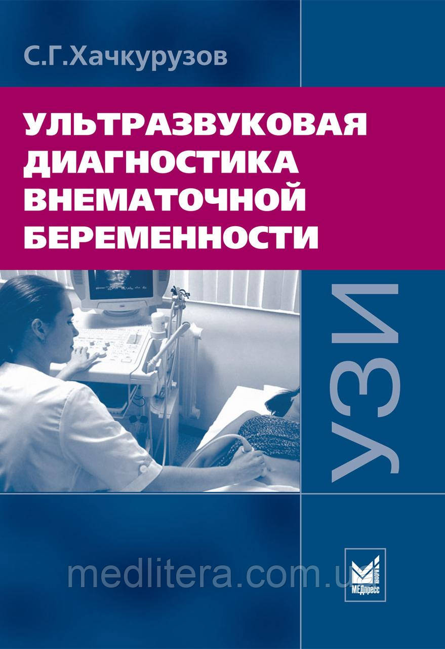 Хачкурузов С. Г. Ультразвуковая диагностика внематочной беременности 3-е изд - фото 1 - id-p41938661