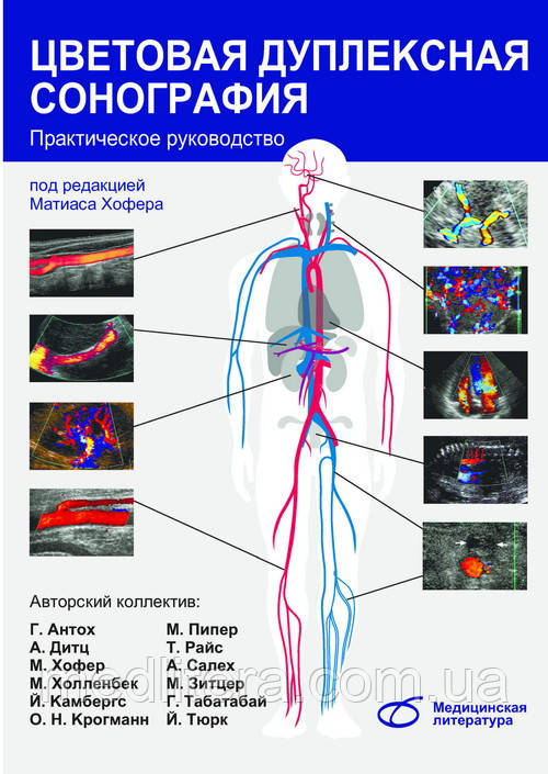 Хофер Матиас Цветовая дуплексная сонография: Практическое руководство - фото 1 - id-p41938829