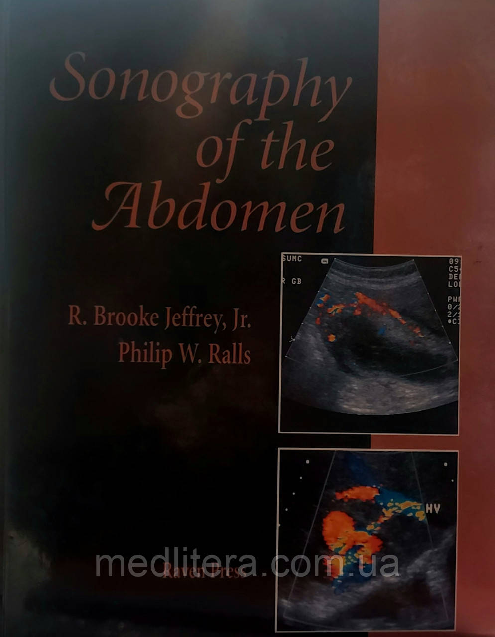 Brooke jefferey. Брук Джеффрі. Sonography the abdomen Абдомінальний сонографія.