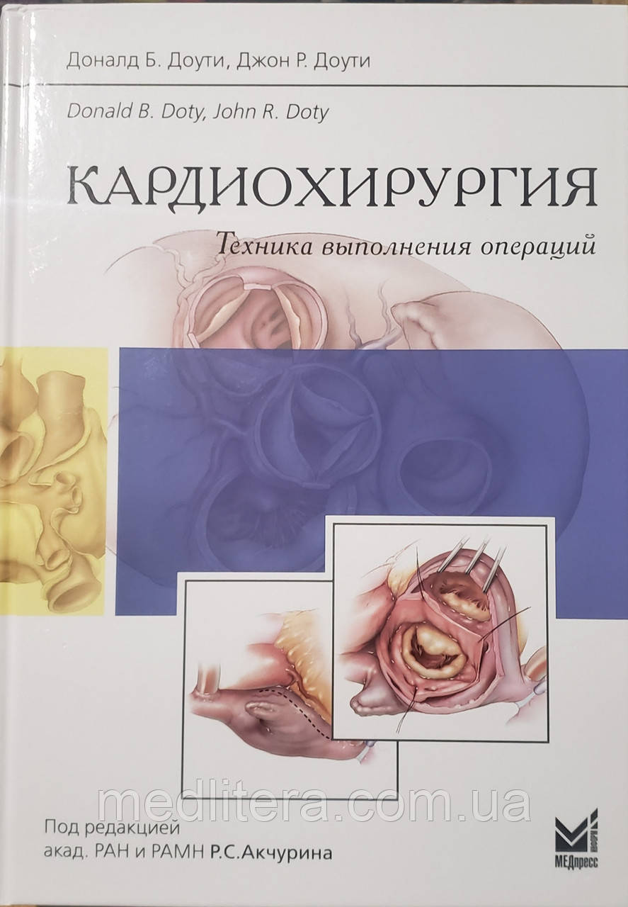 Доуті Д. Б. Кардіохірургія. Техніка виконання операцій 2014 рік керівництво для лікарів