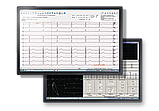 Електрокардіограф триканальний ЮКАРД 100 з вбудованим телеметричним модулем (телеметрія), фото 3