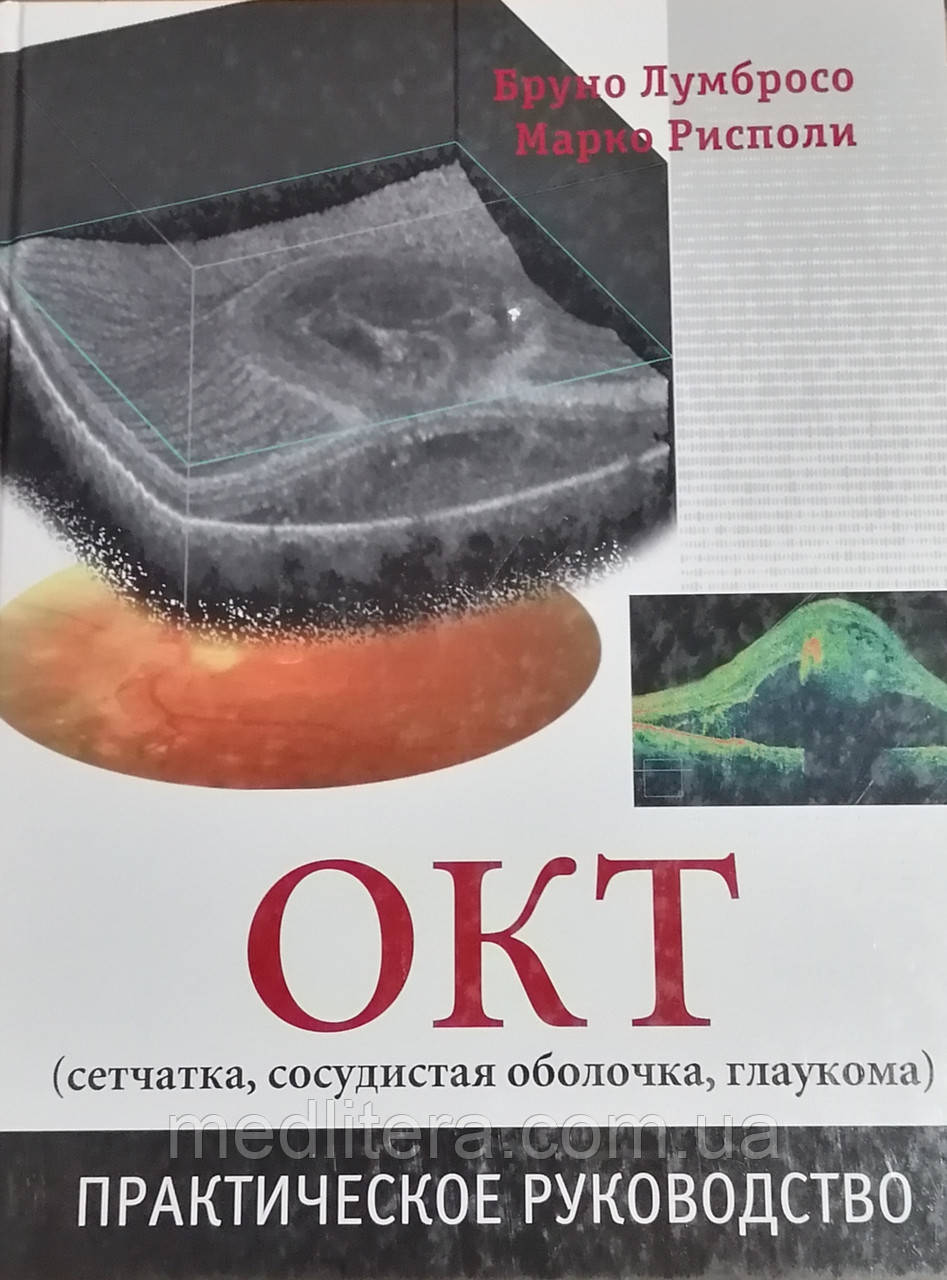 Бруно Лумбросо. Марко Рісполі. ЖОВ (сітківка, судинна оболонка, глаукома)