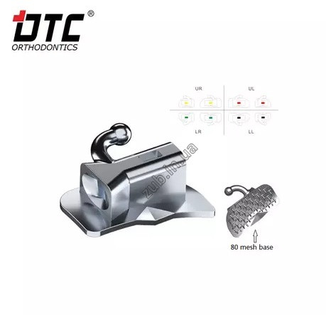 Замок одинарний на 1-й моляр DTC