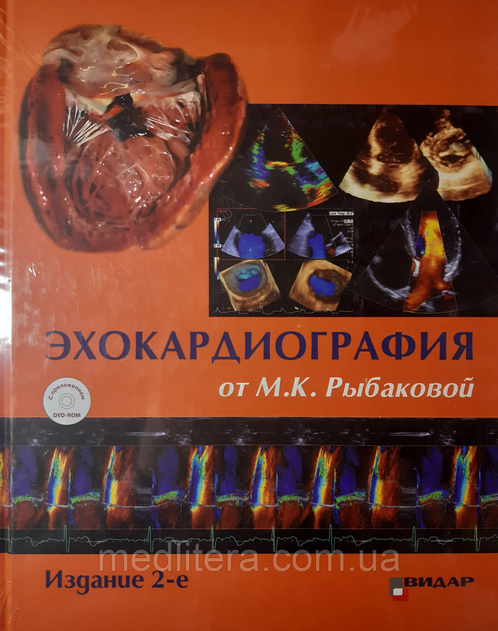 Рибакова М. К. Ехокардіографія від М. К. Рибаковій. Посібник 2-е видання 2018 рік