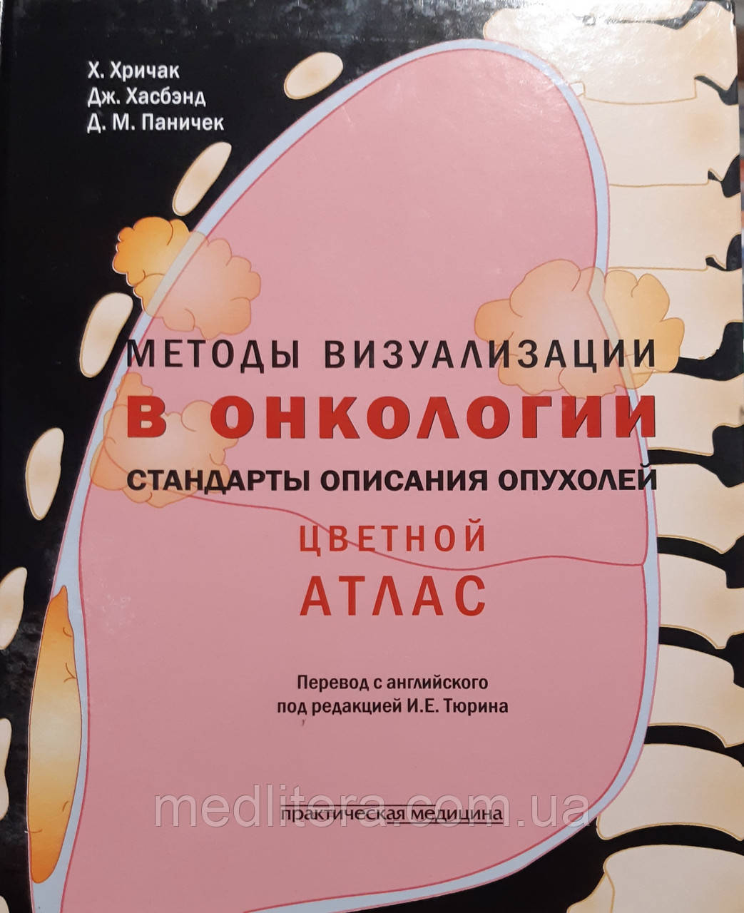 Хричак Х., Хасбанд Д., Паничек Д. Методи візуалізації в онкологи. Стандарти опису пухлин. Кольоровий атлас